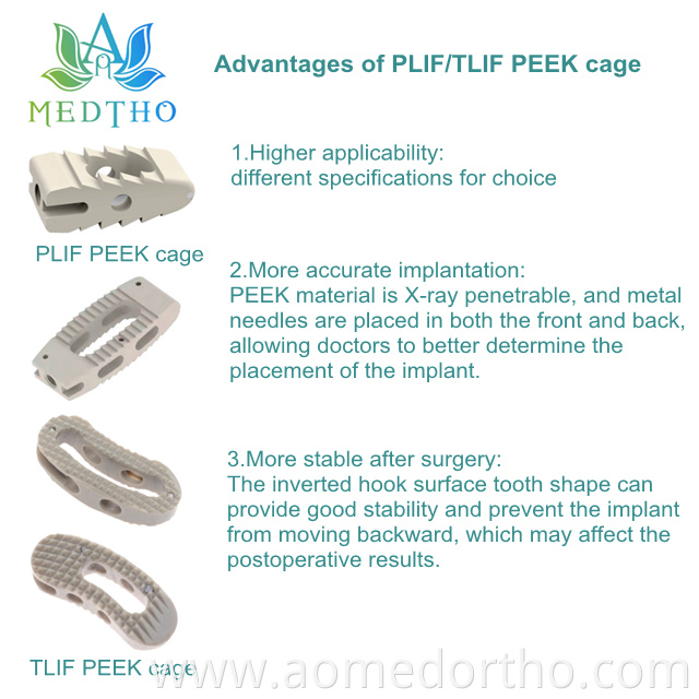 spinal implant